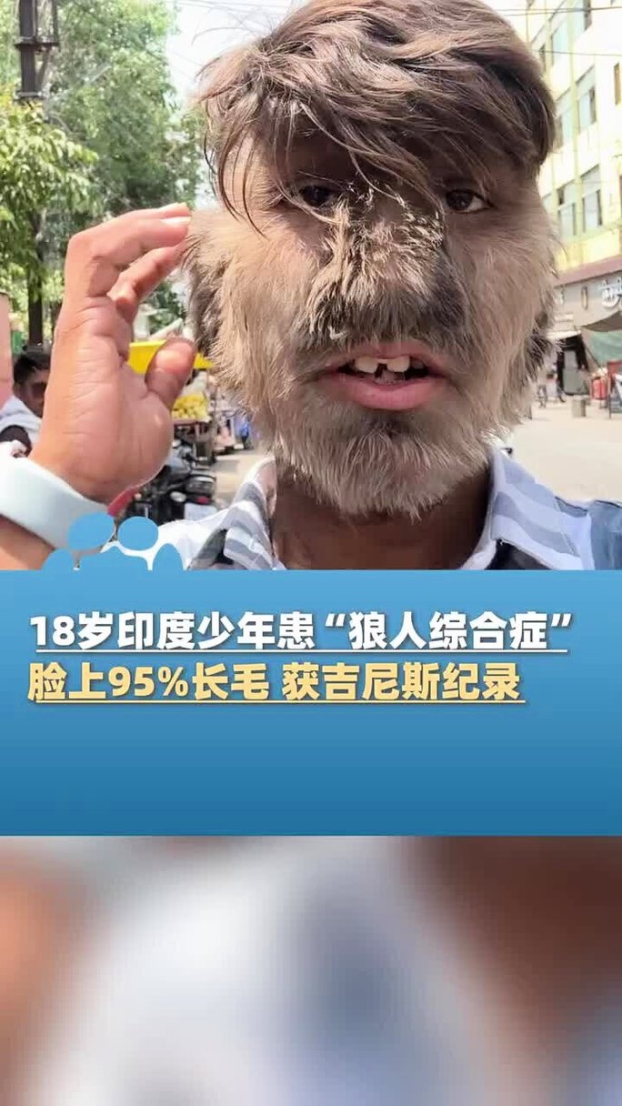 射入少妇亚洲区的相关介绍